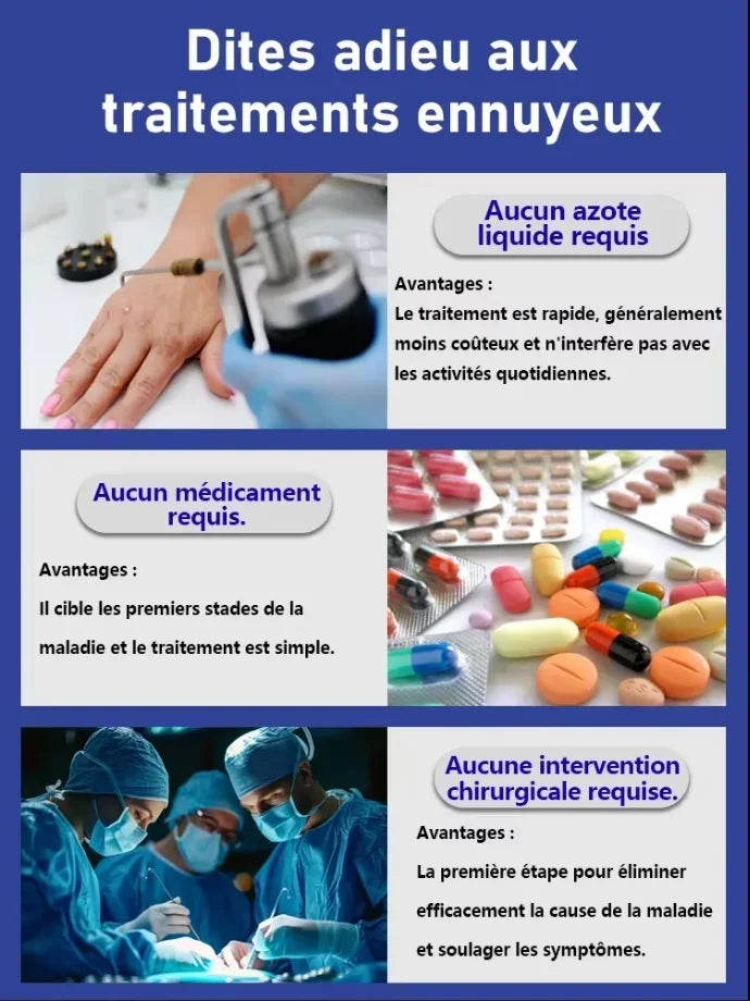 Removedor de Manchas e Verrugas Elétrico – Tratamento Caseiro de Alta Precisão com Luz Azul